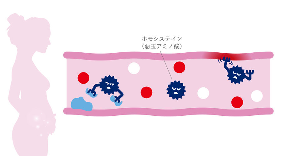 ホモシステイン(悪玉アミノ酸)